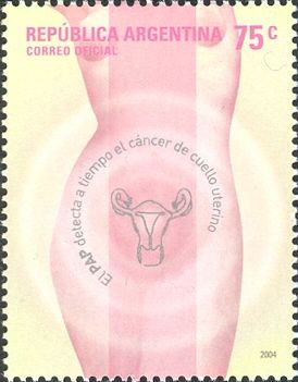 Prevention of Uterine Cancer