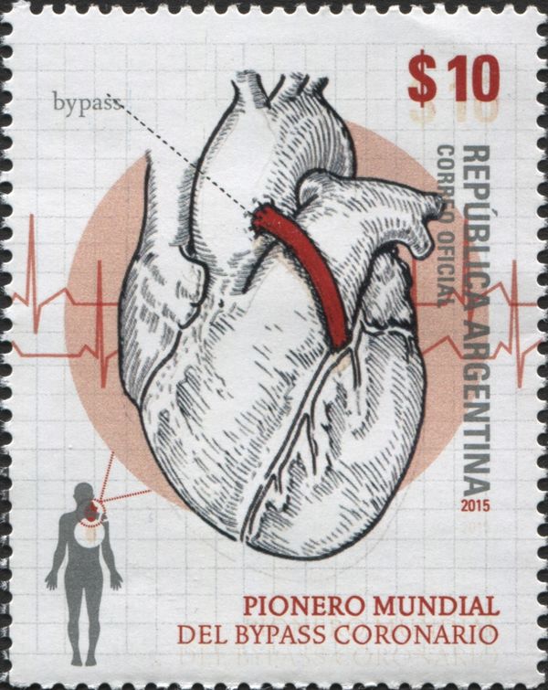 Dr. René G. Favoloro - World Pioneer of the Coronary Bypass