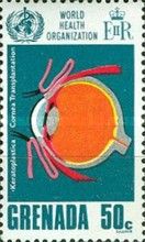 Cornea Transplantation