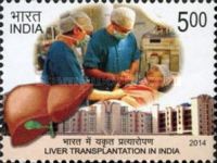 Liver Transplantation in India