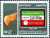 Organ Transplantation