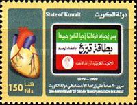Organ Transplantation