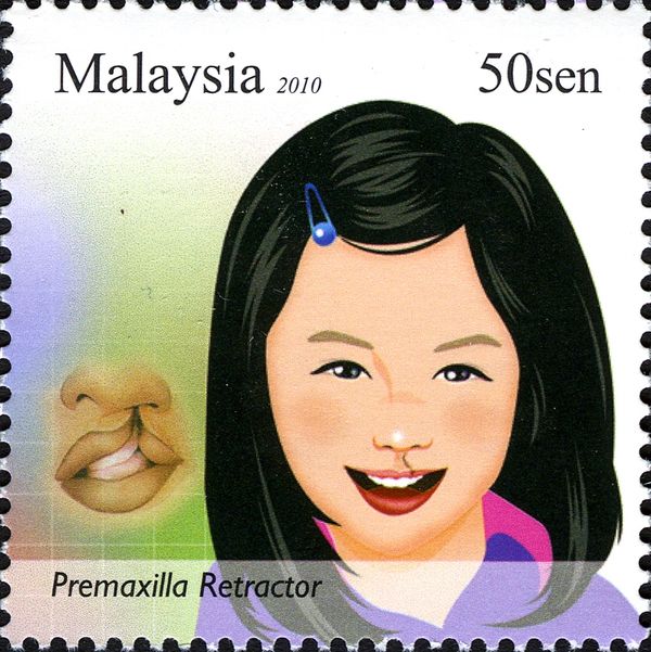 Premaxilla Retractor