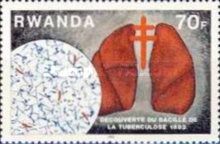 Centenary of Discovery of Tubercle Bacillus