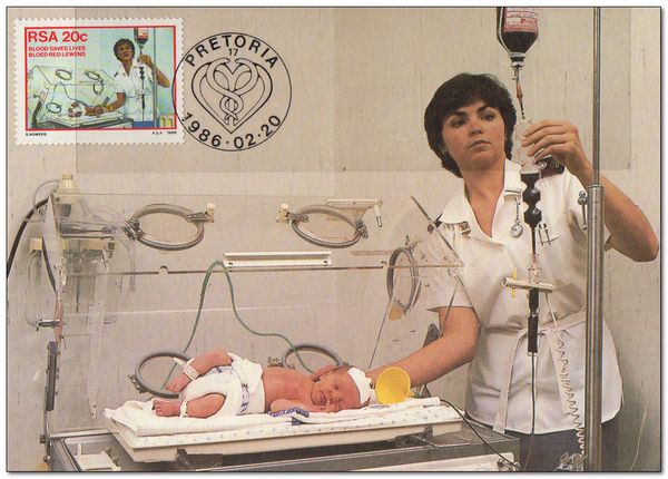 Baby receiving Blood Transfusion