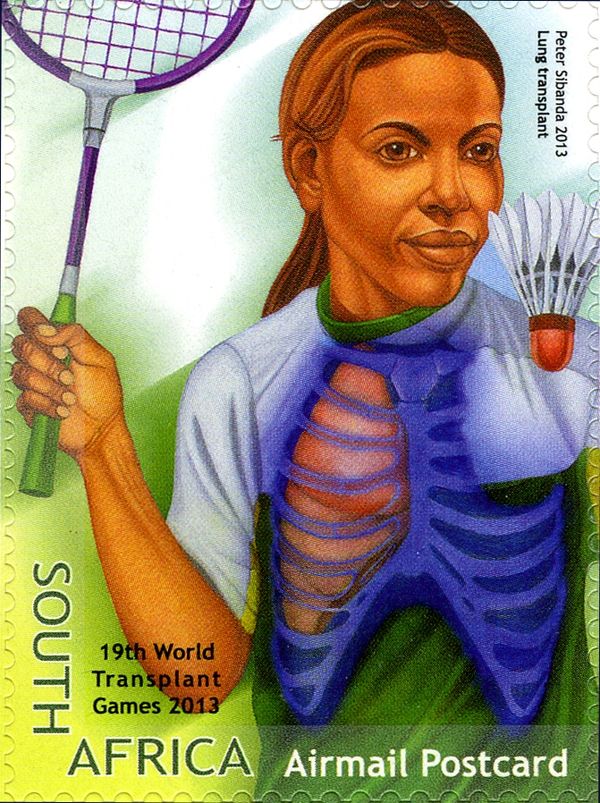 Lung Transplant, Badminton