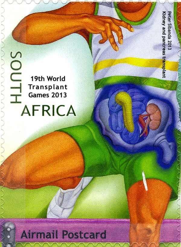 Kidney and Pancreas Transplant, Running