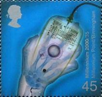 X-ray of Hand holding Computer Mouse (Millennium Point)