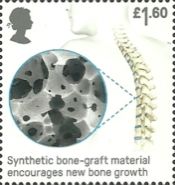 Synthetic Bone Graft