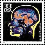 Celebrate the Century - 1970's - Medical Imaging