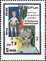 Disfigured child, bombs