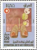 Diseased lungs, details under the microscope
