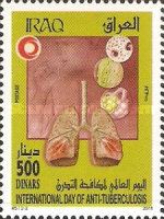 Diseased lungs, details under the microscope