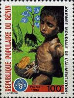 Malnourished child