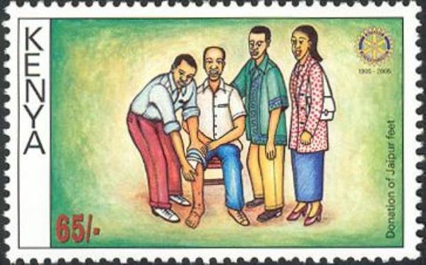 Donation of protheses