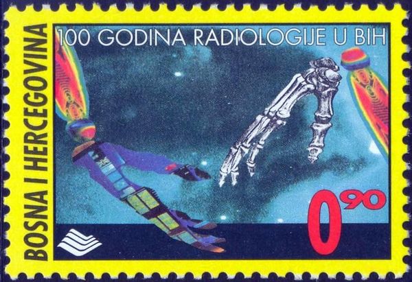 The 100 Years of Radiology in Bosnia and Herzegovina
