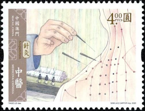 Acupuncture