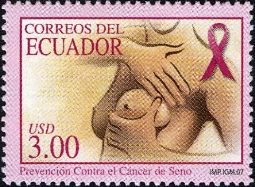 Examining Breast