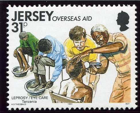 Treating Leprosy, Tanzania