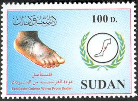 Foot with Ulcers Caused by the Medina Worm